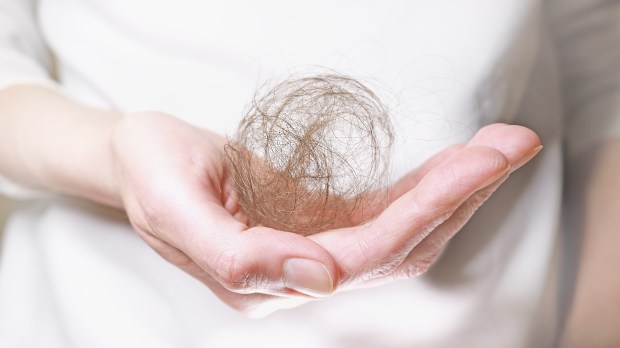Ball-of-hair-on-a-womans-hand